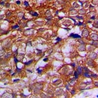 Alpha Tubulin Antibody (C-Terminus)