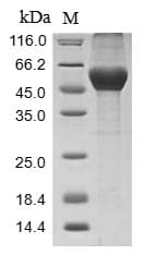 Mouse Serpina3n Protein (Recombinant 10His, N-terminus)