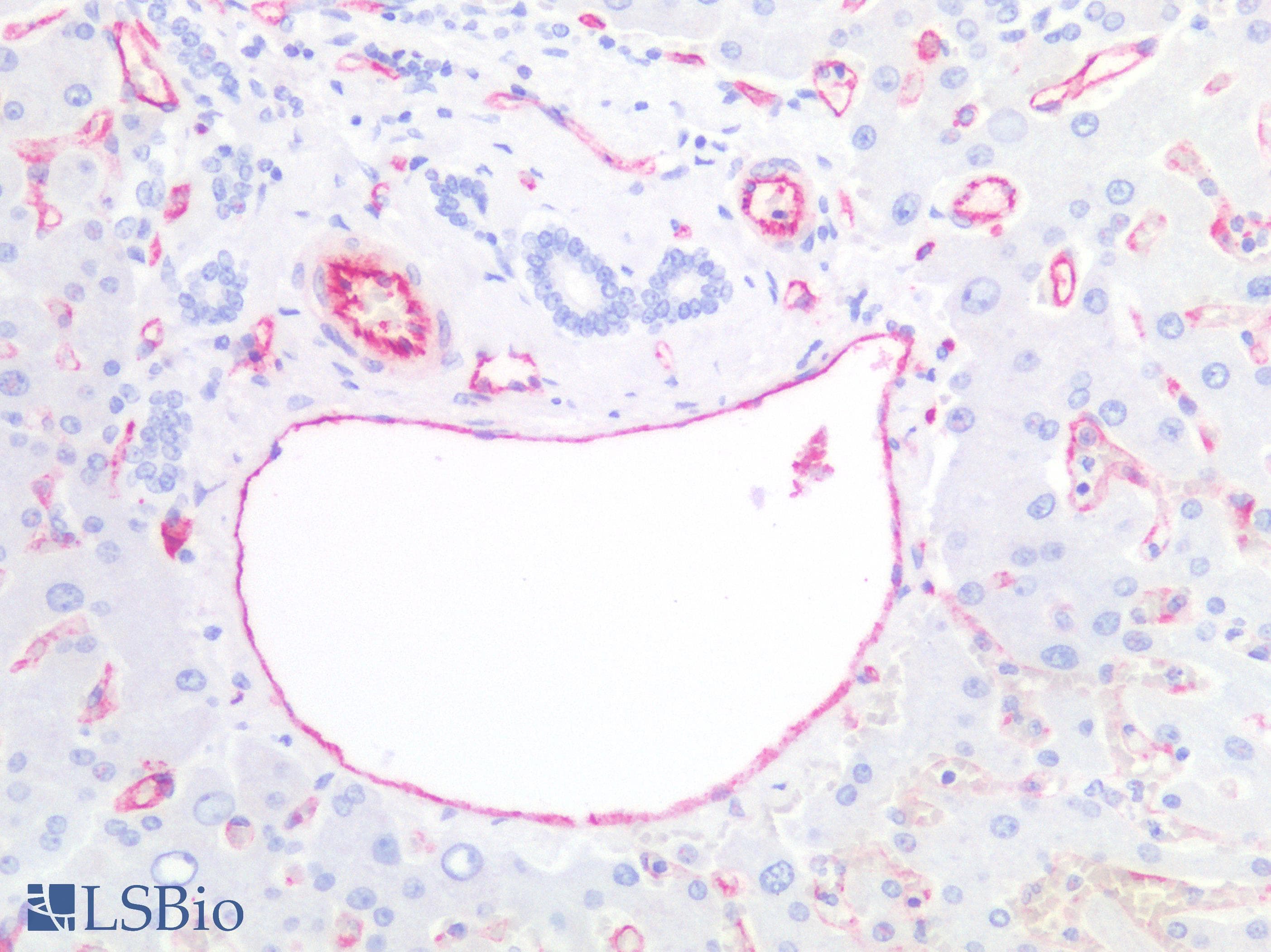PathPlus™ PECAM-1 / CD31 Antibody
