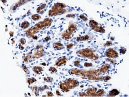 AK5 / Adenylate Kinase 5 Antibody (clone OTI2F9)