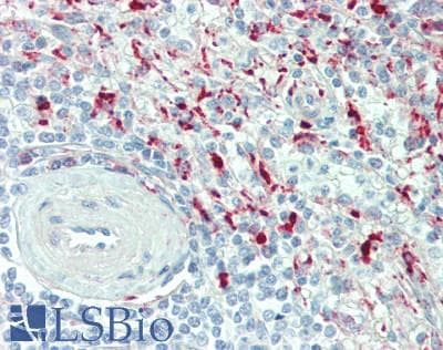 IHC-plus™ Polyclonal Rabbit anti-Human LGMN / Legumain Antibody (aa83-112, IHC, WB)