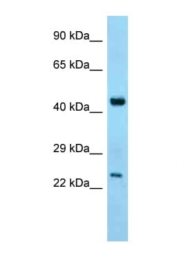 ABHD12 Antibody (C-Terminus)