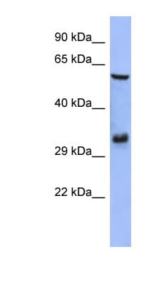 Polyclonal Rabbit anti-Human FRA-1 / FOSL1 Antibody (aa143-192, IHC, WB)