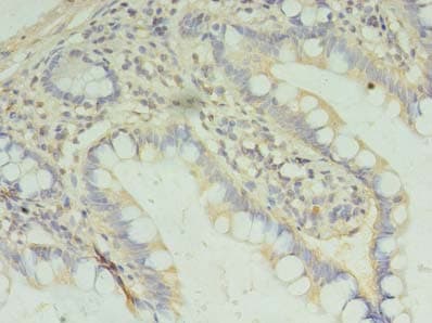 PAFAH1B2 Antibody