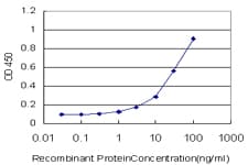 Monoclonal Mouse anti-Human HMBS / PBGD Antibody (clone 3E8, WB)