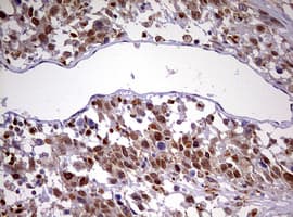 CDCA7L Antibody (aa1-337, clone OTI3B5, Carrier-free)