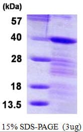 Human LASP1 Protein (Recombinant His)