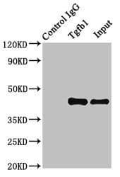TGFB1 / TGF Beta 1 Antibody