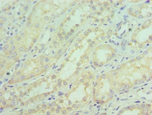 SGTA / SGT Antibody (aa1-120)