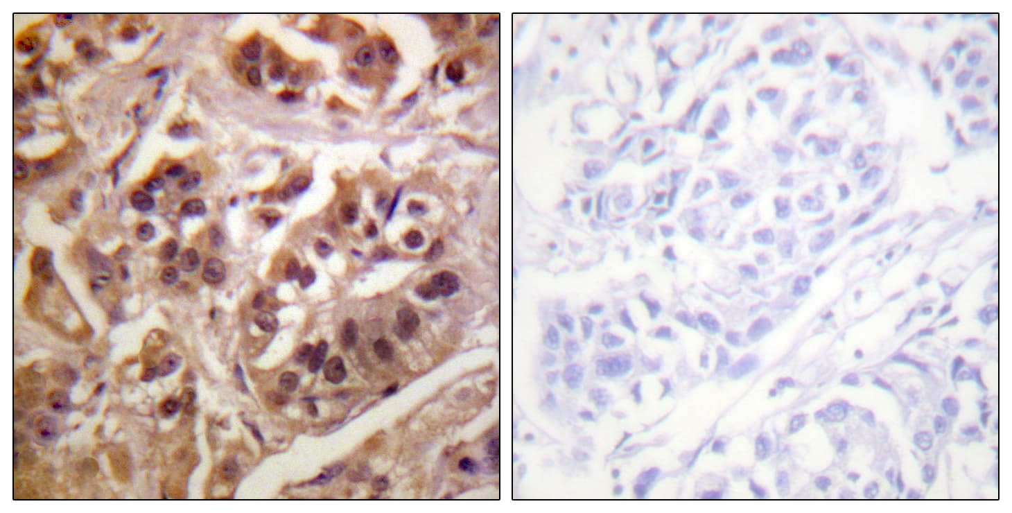 IKBKG / NEMO / IKK Gamma Antibody (aa16-65)