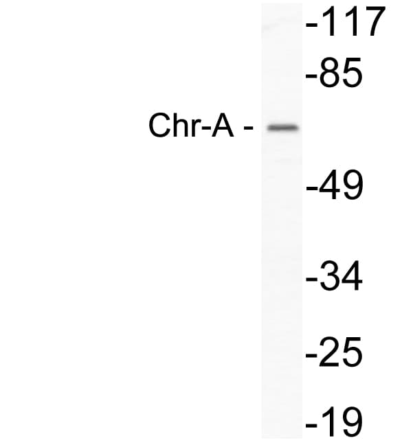 CHGA / Chromogranin A Antibody (Gly360)