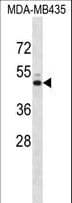IHC-plus™ KCNJ13 / KIR7.1 Antibody (aa67-95)