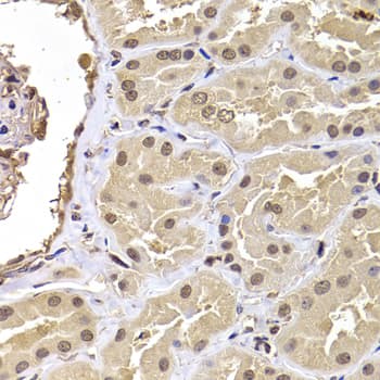 Polyclonal Rabbit anti-Human RPS5 / Ribosomal Protein S5 Antibody (IHC, IF, WB)