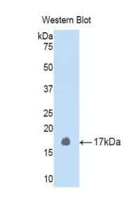 TGFB4 / LEFTY2 Antibody (aa247-358)
