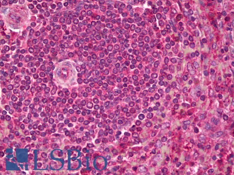 IHC-plus™ Polyclonal Rabbit anti-Mouse PCSK9 Antibody (IHC, WB)