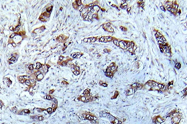 Polyclonal Rabbit anti-Human CAMK2A / CaMKII Alpha Antibody (phospho-Thr286, IHC, WB)