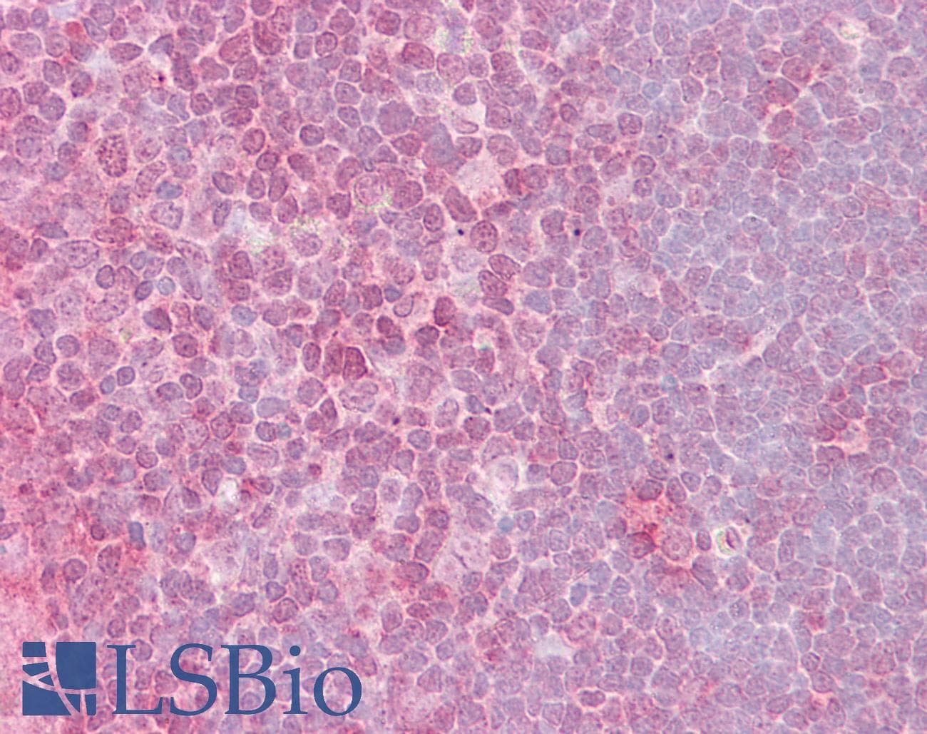 IHC-plus™ CRKL Antibody (aa292-303)