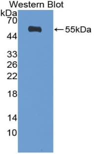 DIAPH1 Antibody (aa389-583)