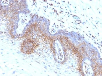 B2M / Beta 2 Microglobulin Antibody (clone SPM617, Azide-free, BSA-free)