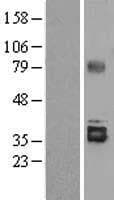 STC2 / Stanniocalcin 2 Protein (Over-Expression Lysate Myc-DDK (Flag))