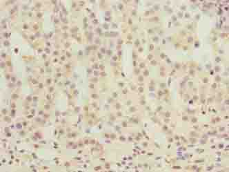 OR2H1 Antibody