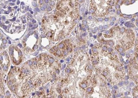 EPHA3 / EPH Receptor A3 Antibody
