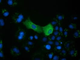 IHC-plus™ CRYM Antibody (clone 1G7)