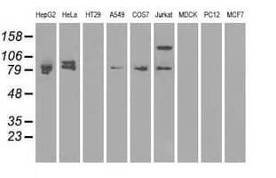 Monoclonal Mouse anti-Human BRAF / B-Raf Antibody (clone OTI1G6, IHC, WB)