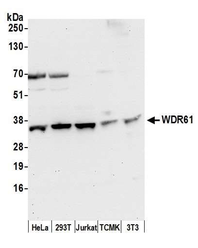 Polyclonal Rabbit anti-Human WDR61 Antibody (aa50-100, WB)