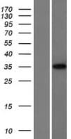 LARP1B Protein (Over-Expression Lysate Myc-DDK (Flag))