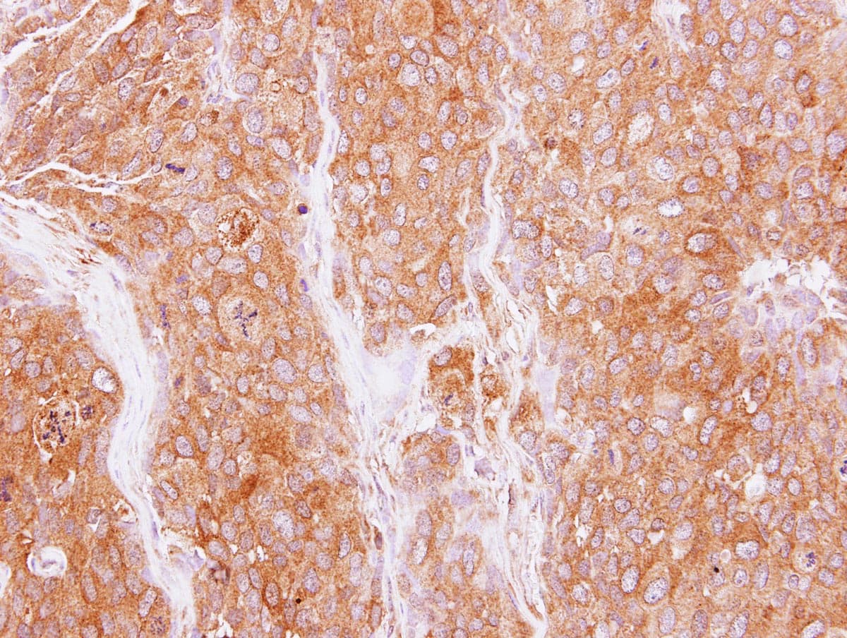 GMF Beta / GMFB Antibody (aa1-142)