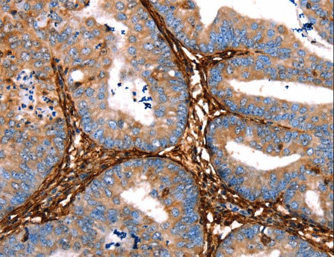 LGALS1 / Galectin 1 Antibody
