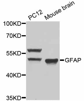 GFAP Antibody
