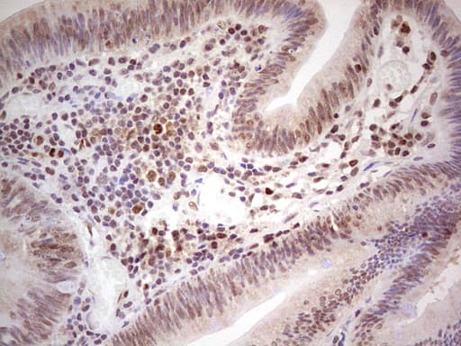 MLH1 Antibody (aa299-527, clone OTI1C1)