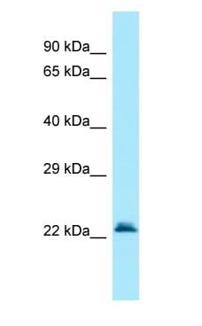 GGCT Antibody (C-Terminus)