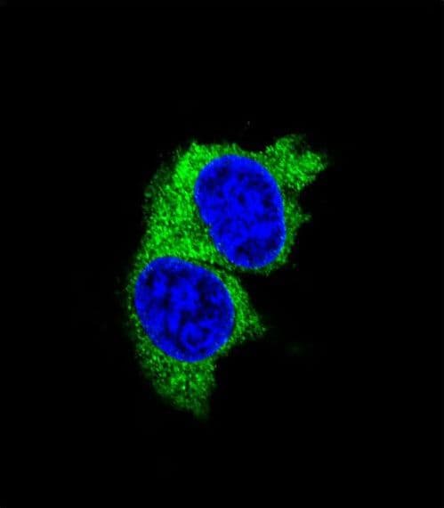 Polyclonal Rabbit anti-Human MMP1 Antibody (aa317-347, IHC, IF, WB)
