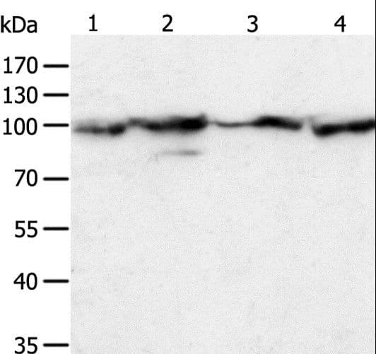 HSP90B1 / GP96 / GRP94 Antibody