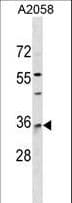 RAB40A / RAR2 Antibody (aa91-118)