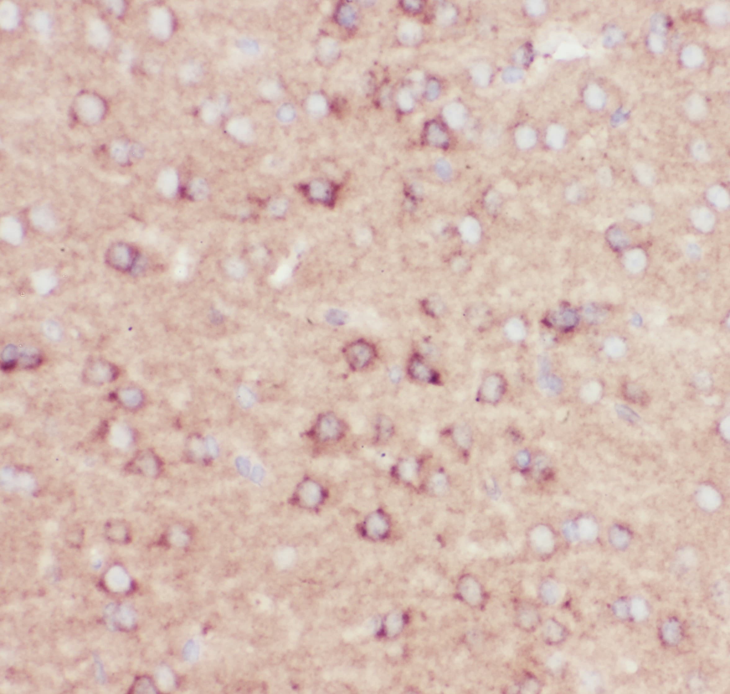 APP / Beta Amyloid Precursor Antibody (aa672-713)