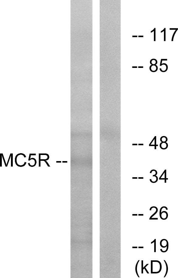 MC5R / MC5 Receptor Antibody
