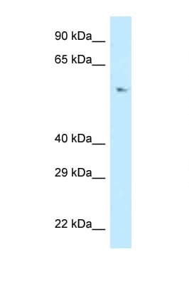 Polyclonal Rabbit anti-Human POLD3 Antibody (C-Terminus, WB)