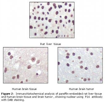 Monoclonal Mouse anti-Human p16INK4a / CDKN2A Antibody (clone 2D9A12, IHC, WB)