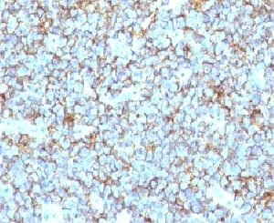 CD99 Antibody (clone MIC2/877, Ready-to-Use)