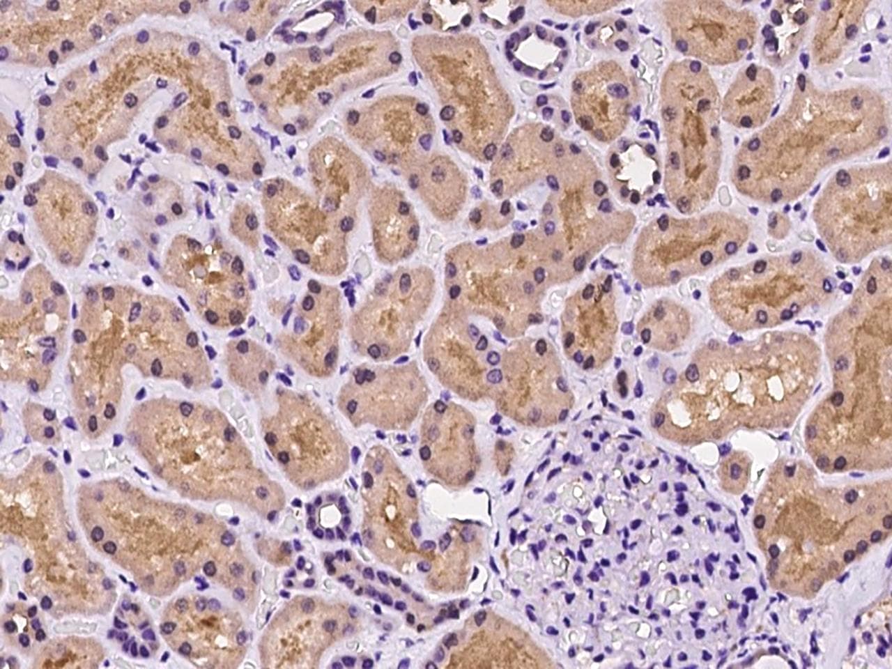 Polyclonal Rabbit anti-Human CDC42EP4 / BORG4 Antibody (IHC)