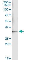 SULT1A1 / Sulfotransferase 1A1 Antibody (clone 1F8)