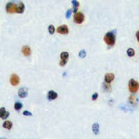 Polyclonal Rabbit anti-Human HEN1 + HEN2 Antibody (Internal, IHC, IF, WB)