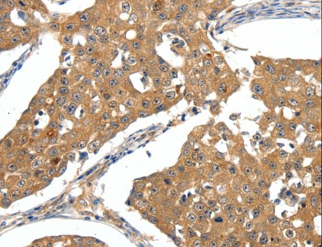 Polyclonal Rabbit anti-Human SCN5A / Nav1.5 Antibody (IHC)