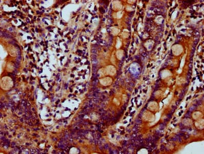 MYO1E / Myosin IE Antibody