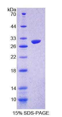 Mouse GAMT Protein (Recombinant His-T7)
