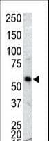 Polyclonal Rabbit anti-Human CAMK1G / CaMKI gamma Antibody (aa420-450, IHC, WB)